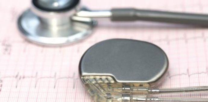 Control de Marcapasos