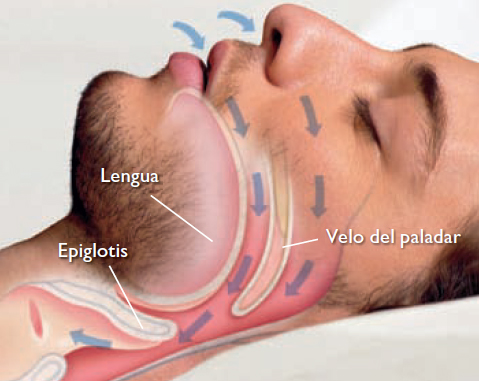 Durante el sueño, el aire puede entrar y salir libremente de los pulmones a través de las vías respiratorias.